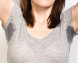 A basic understanding of primary hyperhidrosis