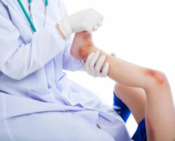 Medical treatment to heal a bruise quickly