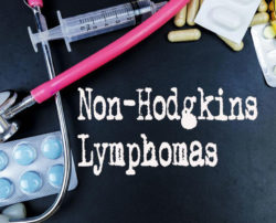 6 common risk factors for Non-Hodgkin lymphoma