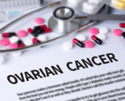 Here’s What You Need to Know about Ovarian Cancer